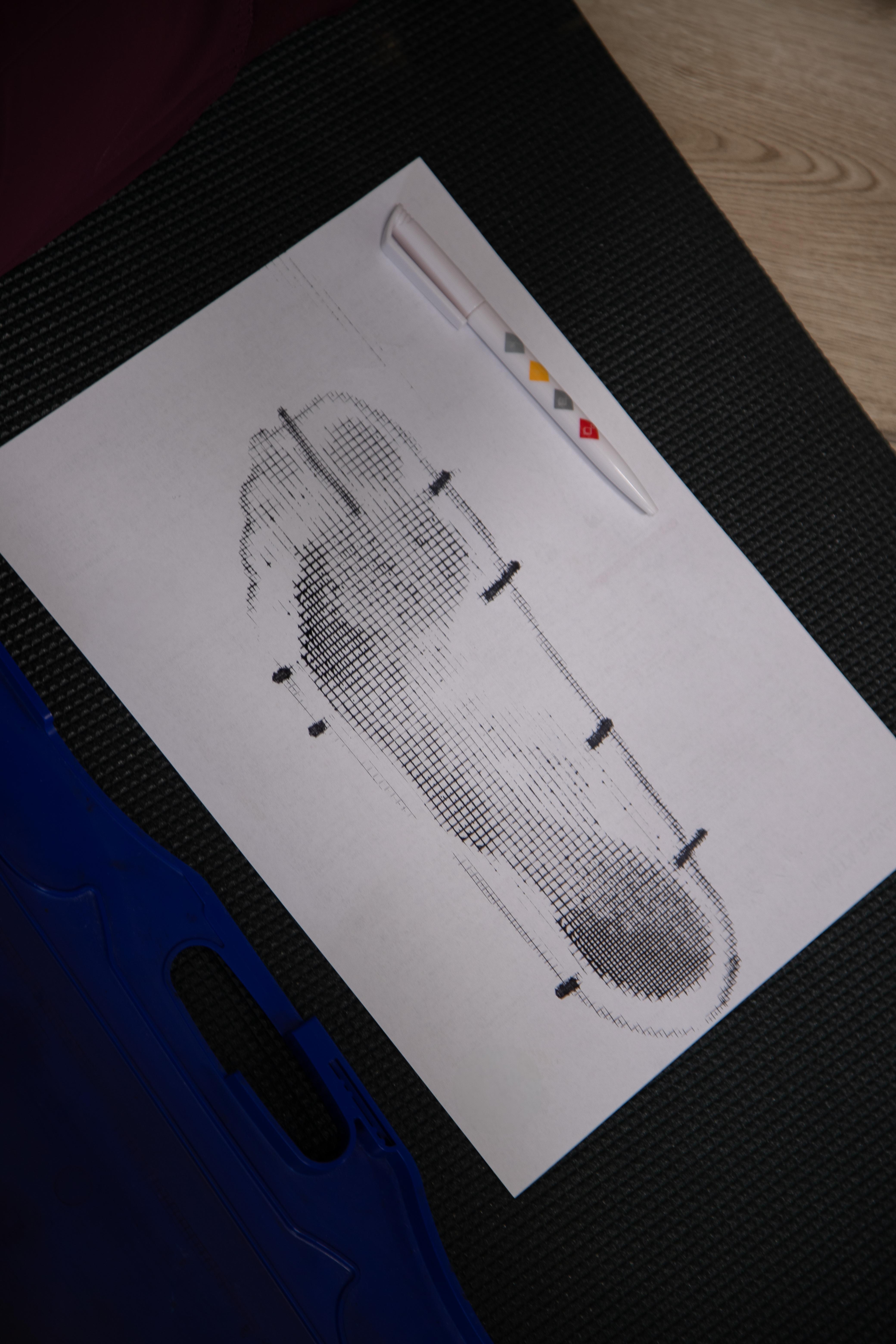 Odbitka plantograficzna — analiza odruchów podeszwowych